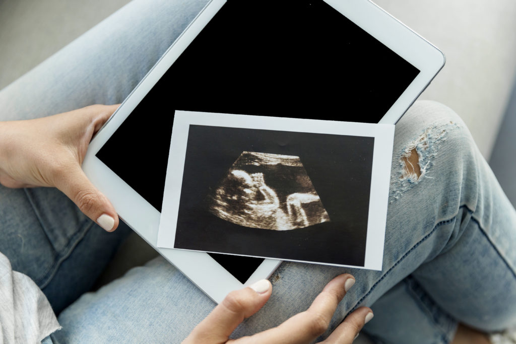 Дочь Олега Тинькова Дарья объявила о беременности с помощью откровенного фото